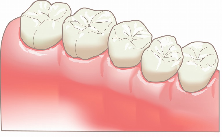 日頃から歯のメンテナンスをしましょう